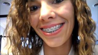 Online film Braces Mouth exam and tour