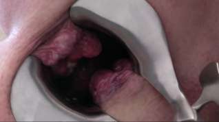 Online film Inside view of my extreme Prolapse asshole