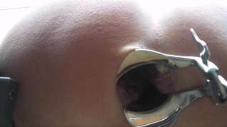 Online film Anal extreme speculum in the asshole
